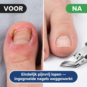 Nagelzange mit schmalen Schneidbacken und geformten Griffen für die Nagelpflege